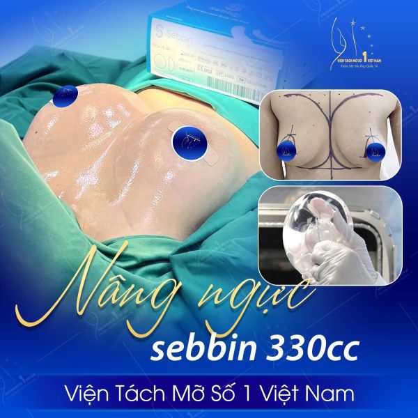 Nâng Ngực Tại Viện Tách Mỡ Số 1 Việt Nam: Bí Quyết Sở Hữu Vòng 1 Hoàn Hảo