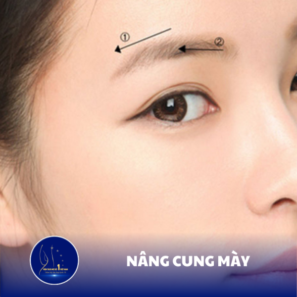 Sở Hữu Đôi Mày Cao Sắc Sảo Với Công Nghệ Nâng Cung Mày Tại Viện Tách Mỡ