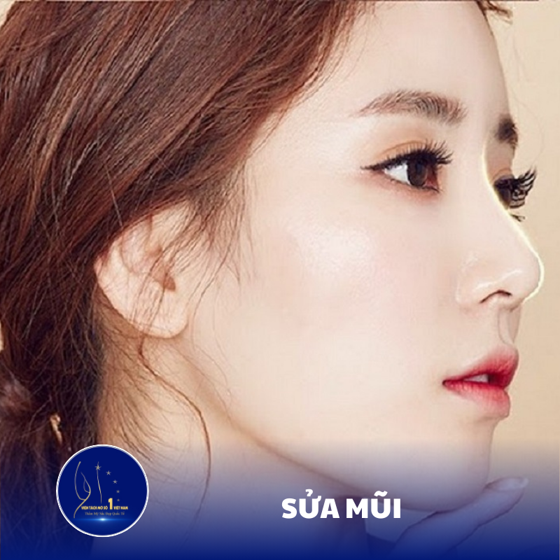 Sửa Mũi An Toàn: Khắc Phục Mọi Khuyết Điểm Mũi Không Hoàn Hảo