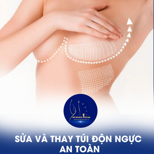 Sửa Và Thay Túi Độn Ngực An Toàn, Hiệu Quả Tại Viện Tách Mỡ Số 1 Việt Nam