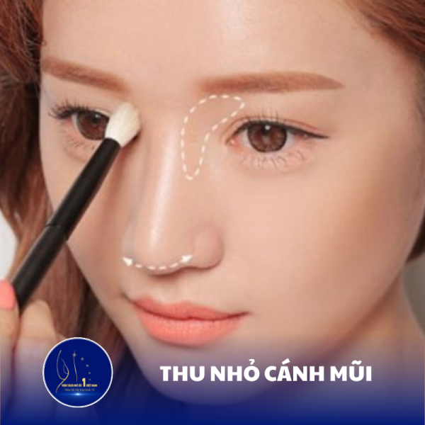 Thu Nhỏ Cánh Mũi: Tạo Dáng Mũi Tự Nhiên Tại Viện Tách Mỡ Số 1 Việt Nam