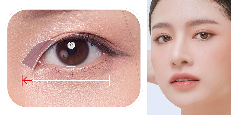 Mở Góc Mắt Trong Và Ngoài: Cải Thiện Vẻ Đẹp Tinh Tế Cho Đôi Mắt