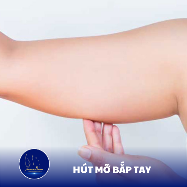 Lấy Lại Cánh Tay Thon Gọn Nhanh Chóng Với Phương Pháp Hút Mỡ Bắp Tay