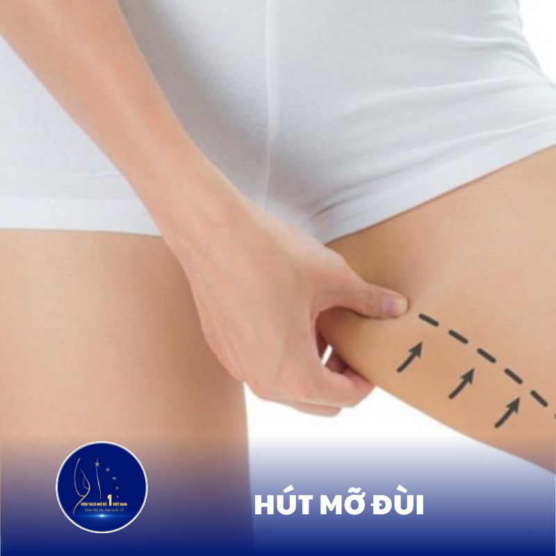 Lấy Lại Đôi Chân Thon Gọn Với Phương Pháp Hút Mỡ Đùi Hiện Đại