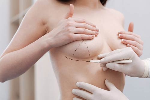 Quy trình treo ngực sa trễ tại Viện Tách Mỡ Số 1 Việt Nam